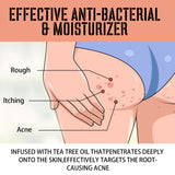 Buttock Care Cream, Repair Rough Buttock Skin Gentle Care Moisturizing And Moisturizing Skin - V.I.P Digital Presence