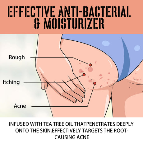 Buttock Care Cream, Repair Rough Buttock Skin Gentle Care Moisturizing And Moisturizing Skin - V.I.P Digital Presence