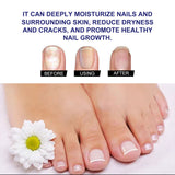 Plant Drops, Repair Extremities Soft Thickening Light Armour Moist Clean Fingernails Detailer - V.I.P Digital Presence