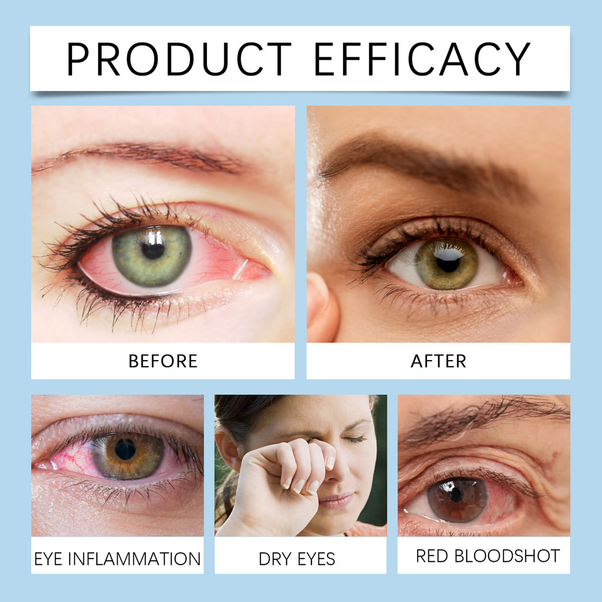 Eye Drops, Eye Moisturizing Drops Relieve Dryness Soothing Moisturizing Maintenance Eye Health Care Solution - V.I.P Digital Presence