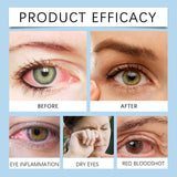 Eye Drops, Eye Moisturizing Drops Relieve Dryness Soothing Moisturizing Maintenance Eye Health Care Solution - V.I.P Digital Presence