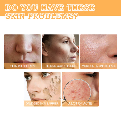 Glycolic Acid 7% Toner, Remove Acne Lighten Acne Repair Acne Mark Moisturize Skin Toner - V.I.P Digital Presence