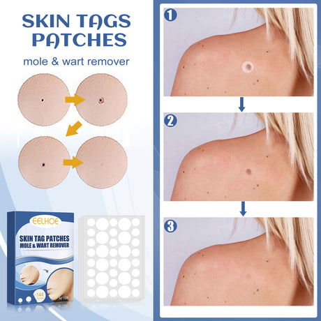 Kew Patch Gentle Cleaning Care Skin Face Neck Repair Smooth Skin Daily Care - V.I.P Digital Presence