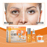 Kit de cuidado facial con vitamina C, hidratante, rejuvenecedor y para pieles sensibles.
