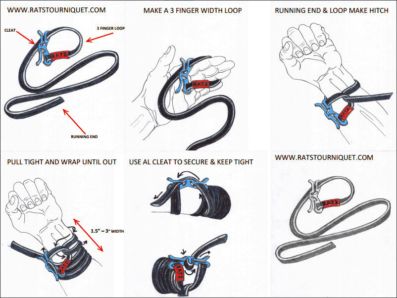 Jungle fast tourniquet poison belt One hand operation Light and easy to use EDC outdoor survival equipment - V.I.P Digital Presence