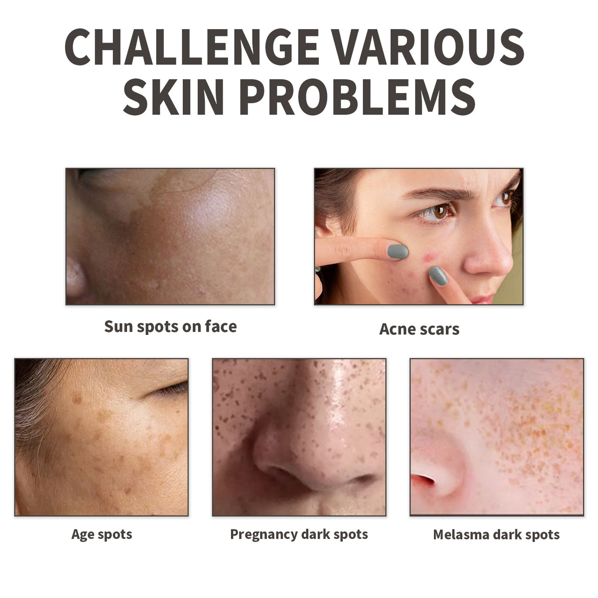 Dark Spot Serum, Fade Spot Moisturize Skin Repair Blain Mark Face Dull Shine Essence - V.I.P Digital Presence