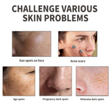 Dark Spot Serum, Fade Spot Moisturize Skin Repair Blain Mark Face Dull Shine Essence - V.I.P Digital Presence