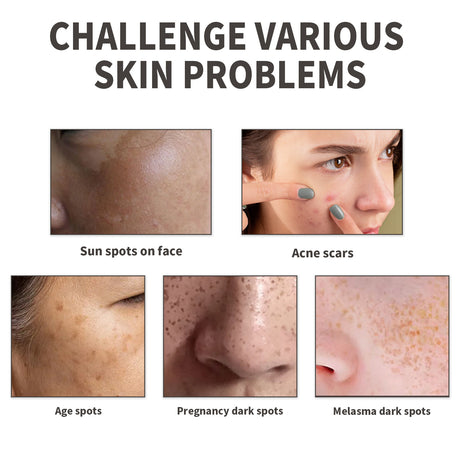 Dark Spot Serum, Fade Spot Moisturize Skin Repair Blain Mark Face Dull Shine Essence - V.I.P Digital Presence
