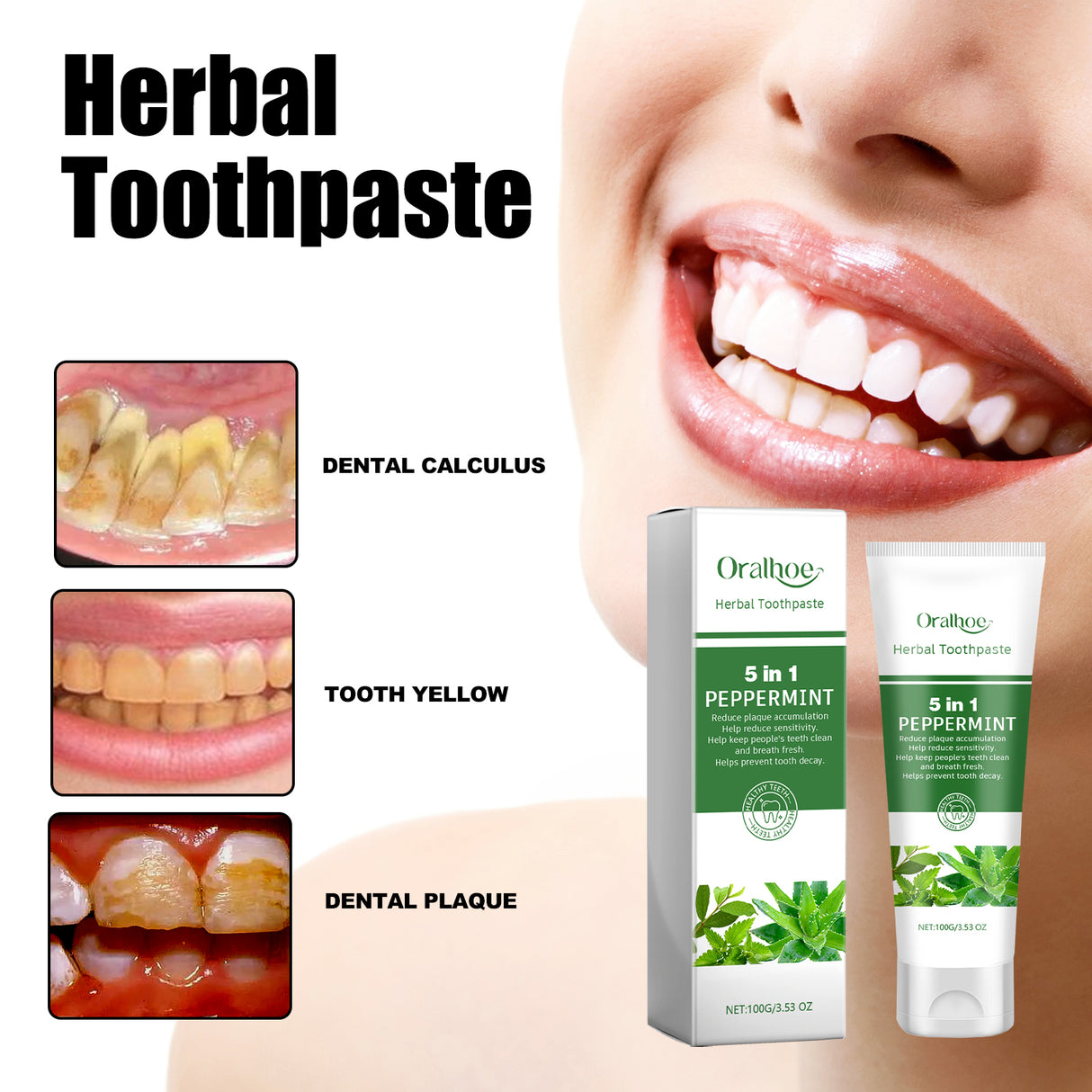 Aloe Whitening Toothpaste Cleans Mouth, Removes Odor, Freshens Breath, Removes Stains, Brighens Teeth And Beautifies Teeth - V.I.P Digital Presence