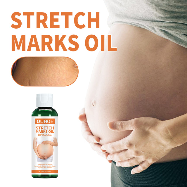 Pregnancy Massage Oil, Repair Pregnant Women Prenatal And Postpartum Stretch Mark Skin Care Massage Oil - V.I.P Digital Presence