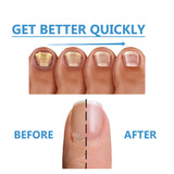 Toenail Fungus Treatment, Repair The Brotherhood Of Nails Rotten Jiasheng Mail This Soft Armour A Detailer - V.I.P Digital Presence