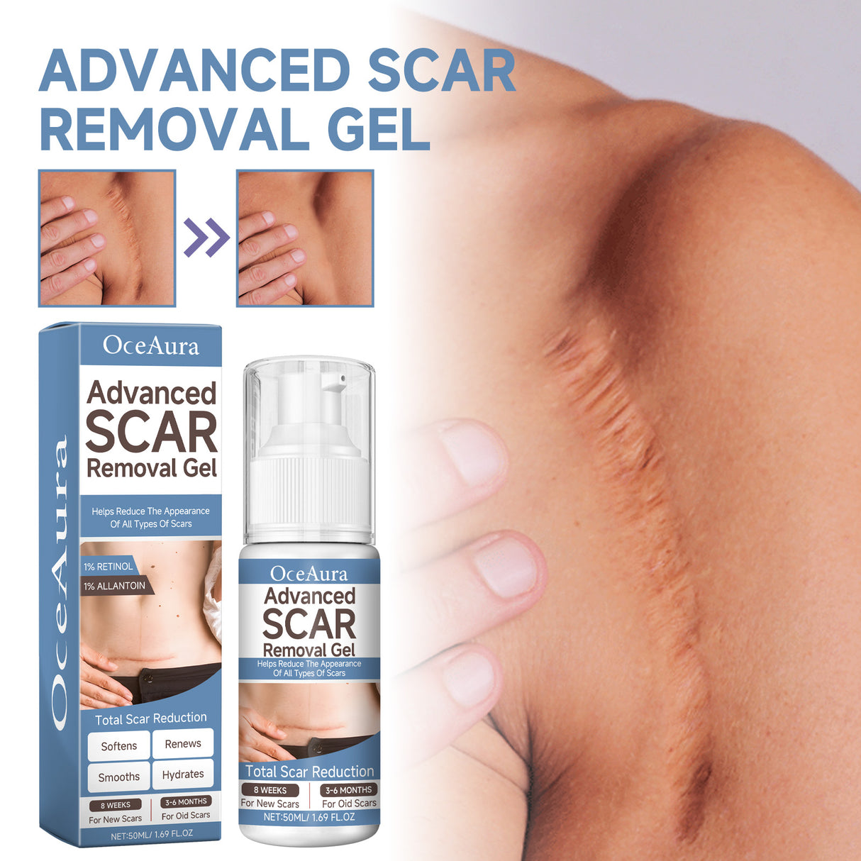 Oceaura Scar Whitening Repair Gel Moisturizes And Smooths Skin Repair Surgery Scar Pregnancy Care Gel - V.I.P Digital Presence