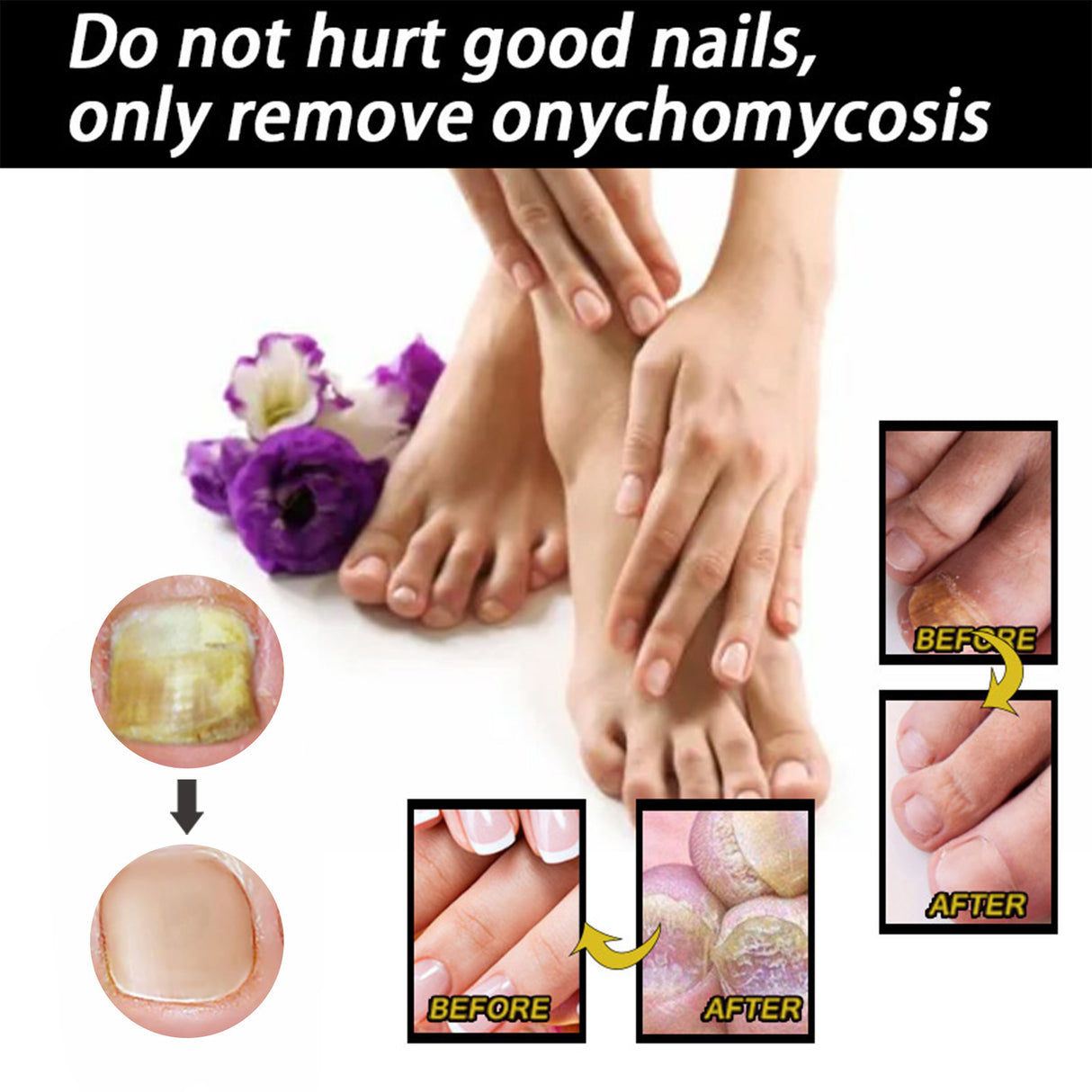 Nail Repair Solution Thickening Brightening Nails Removing Gray Nails Dead Skin Repair Nourishing Nail Care Solution - V.I.P Digital Presence