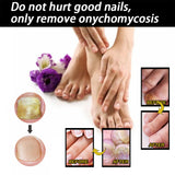 Nail Repair Solution Thickening Brightening Nails Removing Gray Nails Dead Skin Repair Nourishing Nail Care Solution - V.I.P Digital Presence