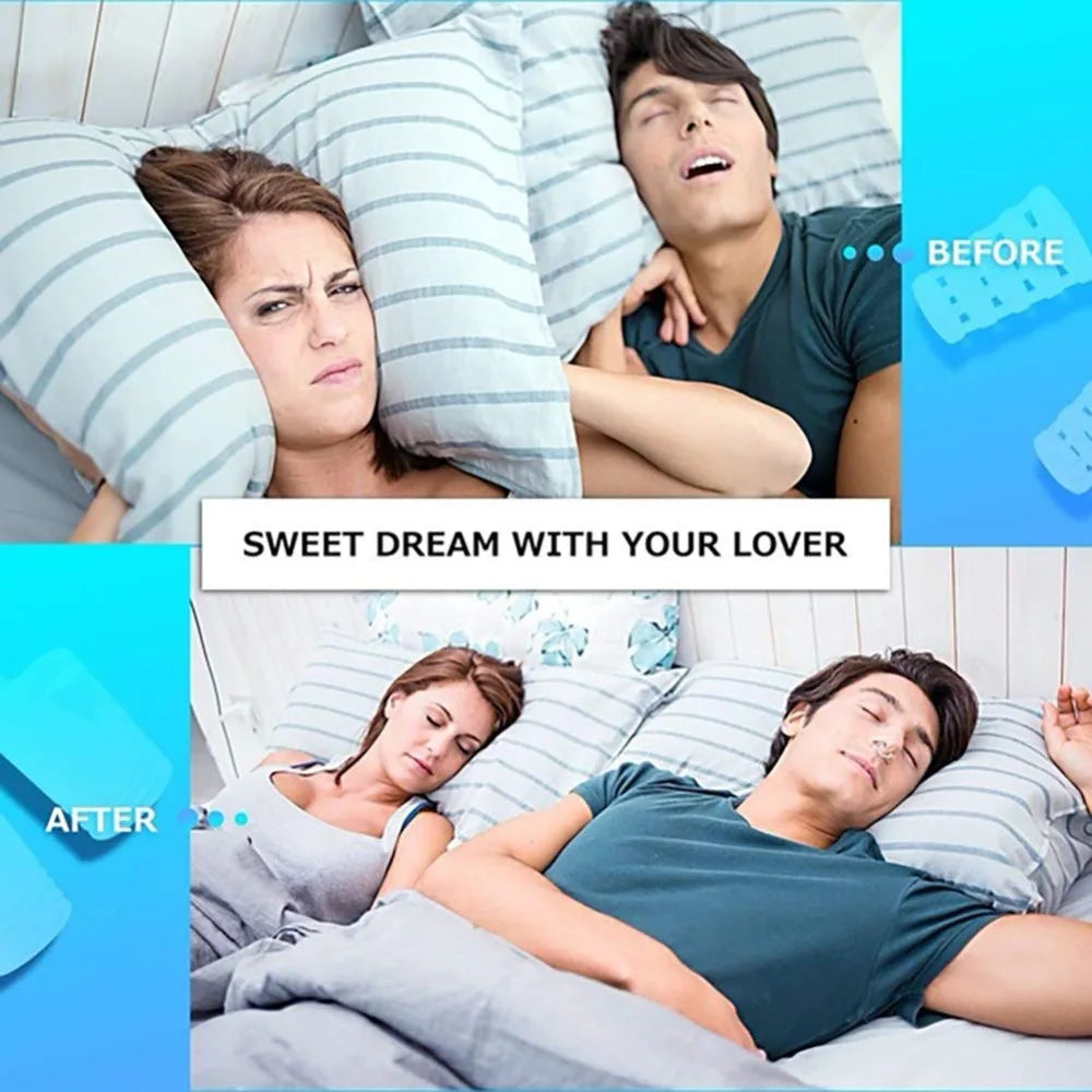 8PCS /set Snoring Solution Anti Snoring Devices Professional Snore Stopper Nose Vents Snore Nasal Dilators For Better Sleep - V.I.P Digital Presence