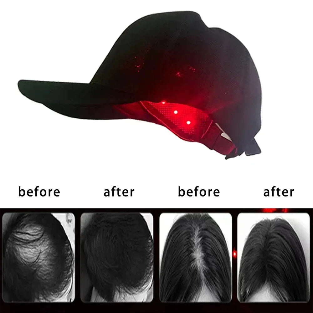 DualBeam HairCap - V.I.P Digital Presence